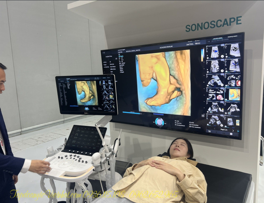 Máy siêu âm 5D SonoScape P50 Elite